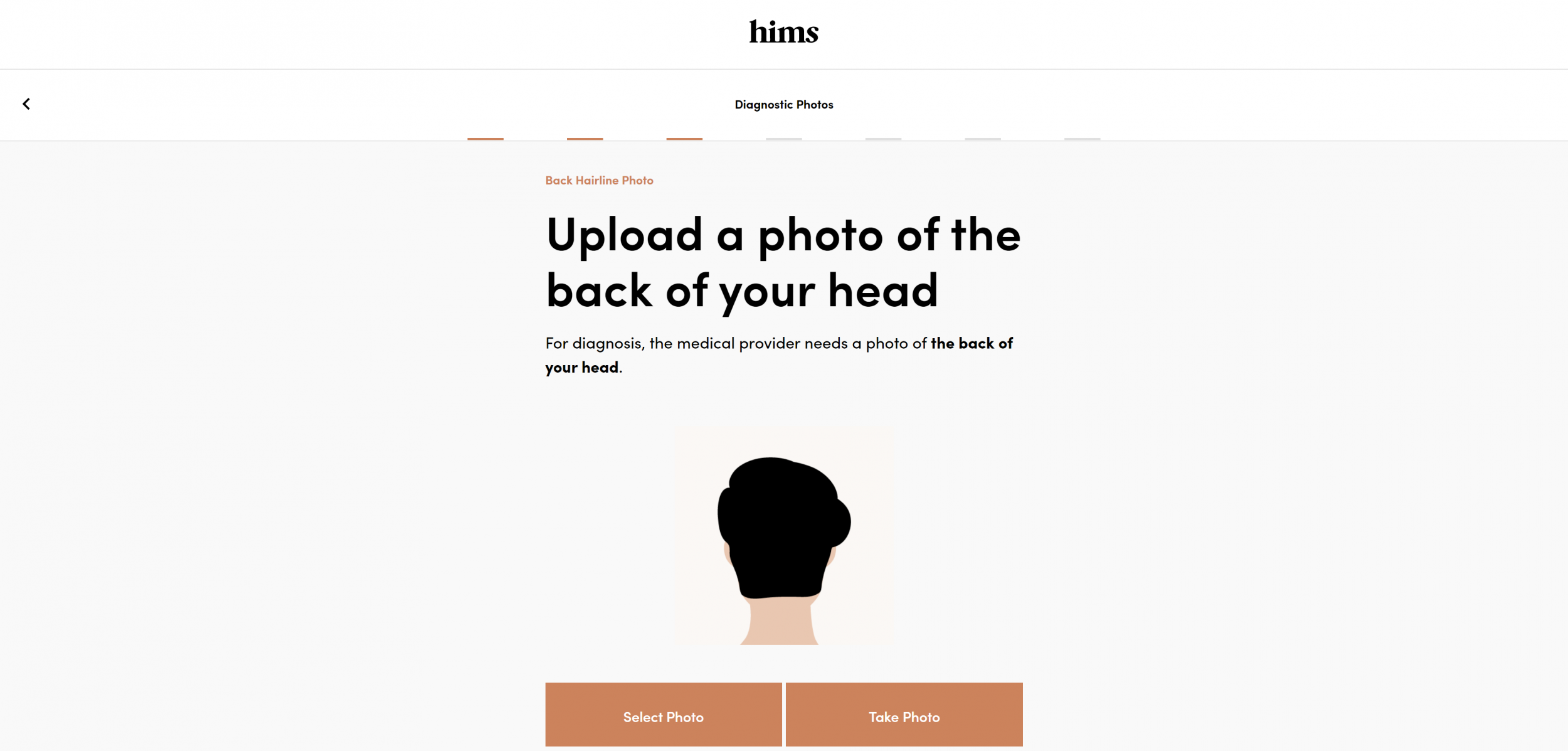 screenshot of hims hair loss treatment questionnaire